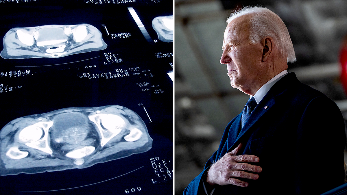 joe biden next to image of prostate cancer screening