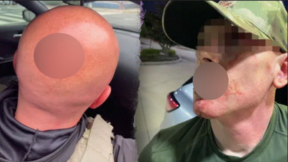 Injured ICE agents.