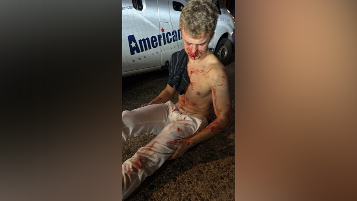 Former DOGE employee Edward Coristine was attacked Monday while trying to help a woman, according to sources.